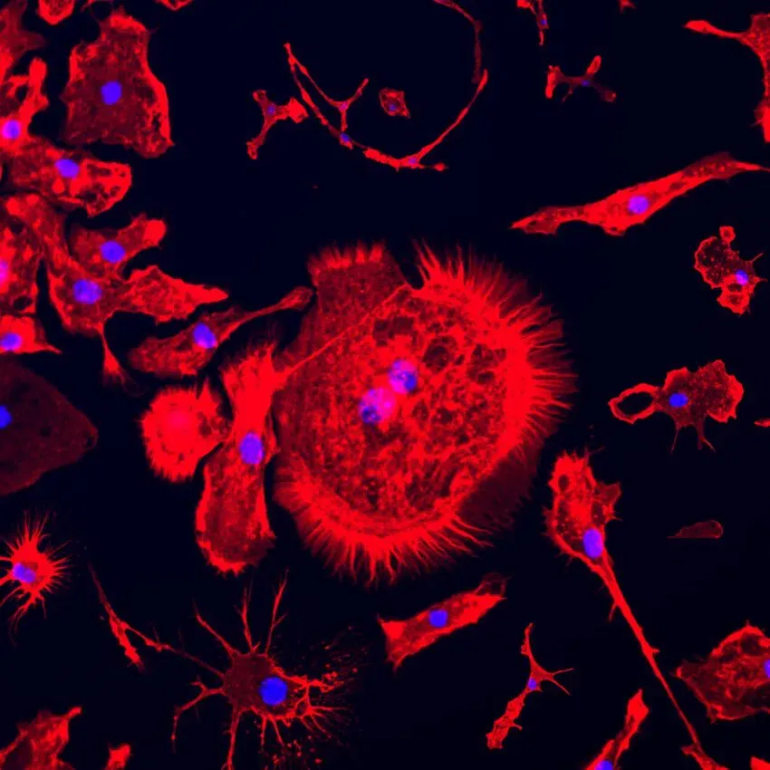 Proyecto convierte células cancerosas en nft 6 Células de cáncer nft